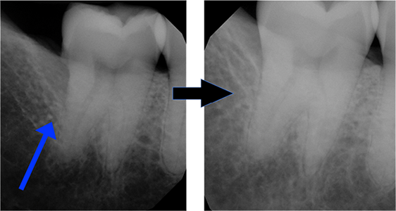 Tooth Diagram